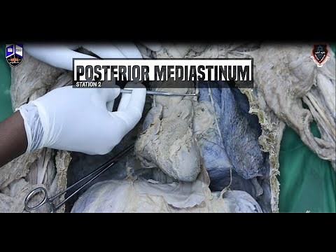 Thorax I Practical 3 | Station (2): Posterior Mediastinum