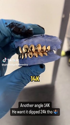 14K Perm Style🔥 Glee Gang Style🔥 Florida Style🔥 “Everythang Glee” #gleefullgrillz #24k #florida #fyp #glee #grillz #smile #14k #yellowgold