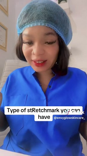 #envyglowskincare #skincaretips #viral