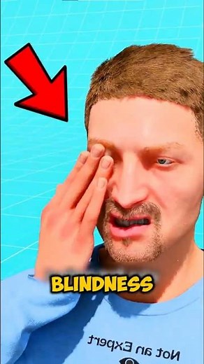 Stop Rubbing Your Eyes… You Could Be Damaging Your Vision 👁️
