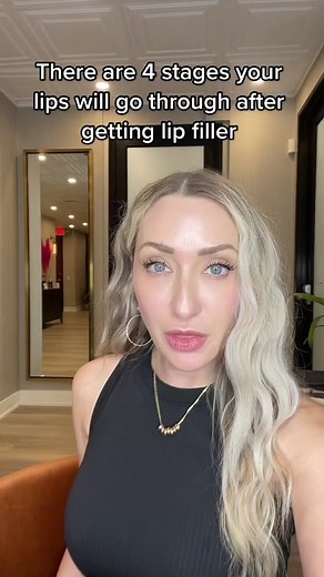 First Time Lip Filler: What to Expect and Tips for Beginners