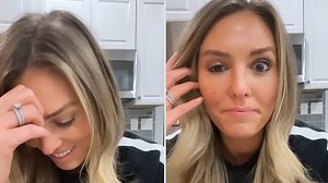 Influencer reveals disastrous side effects of botched Botox