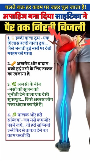 दबी नसं की चीख - साइटिका 🔥😩🙏 #viralshorts #viralvideo #sciaticatreatmentinhindi #physiodrdeepaksoni