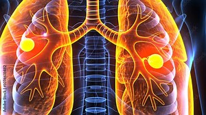 This illustration clearly depicts the human lungs, focusing on the bronchial tree structure and alveoli, with vivid colors emphasizing their respiratory functions Stock Video
