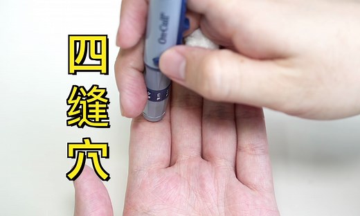 四缝穴，小儿疳积，积食，脾胃弱，百日咳。生活小妙招～