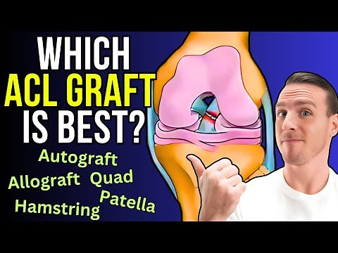 The Ultimate Guide To Choosing an ACL Graft
