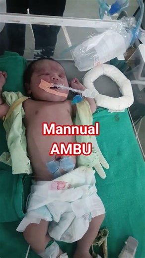 AMBU bag