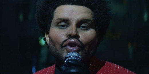 Why The Weeknd Has Been Bandaging His Face