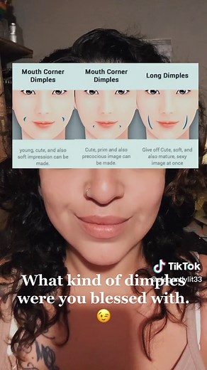 Types of Dimples: Exploring Different Kinds and Variations