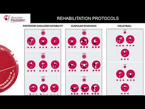 The Shoulder Pacemaker™ device | The MAS stimulator to treat shoulder: what is it and how it works