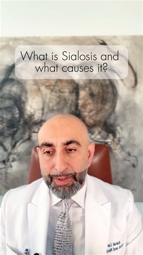 What is Sialosis and what causes it? Dr. Babak Larian explains. Dr. Larian understands how challenging and overwhelming parotid-related issues can be. You don’t have to face it alone — virtual consultations are available to give you clarity and guidance. 👉 Click the Linktree link in our bio to schedule your consult today. 📞 (310) 461-0300 www.parotidmd.com https://linktr.ee/parotidcenter Comment “Sialosis” and we’ll dm you a 🔗 for more information about treatment for Sialosis. #sialosis #paro