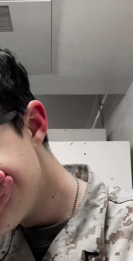 Why Are My Ears Turning Red? Explained!