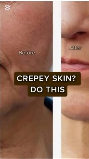 How To Fix Crepey Skin (day1 of 7day Skin Rejuvenation)