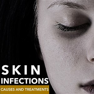 Common fungal skin infections are caused by various reasons. Know the reasons and treat it the right way! | Glamrs