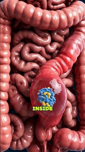 Why your Appendix EXPLODES... 😱💥