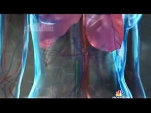 NBC IVC Investigation Part 1