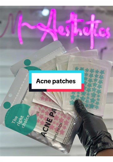 Acne patches are small but powerful skincare essentials designed to target pimples fast🤗They help absorb excess oil and impurities, protect breakouts from dirt and bacteria, and speed up healing without drying out your skin. Simply place on clean skin and let the patch do the work while you glow on. acne patches limbe acne patches how to use acne patches recommend acne patches hydrocolloid best pimple patches for acne acne patches routine acne patches big acne patches in Cameroon acne patches d