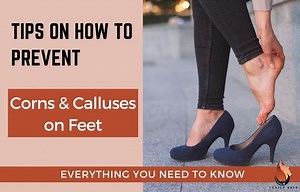 7 Tips on How to Prevent Calluses & Corns on Your Feet - Sasily Skin