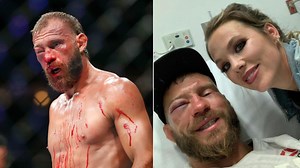 Donald 'Cowboy' Cerrone's horrific injury