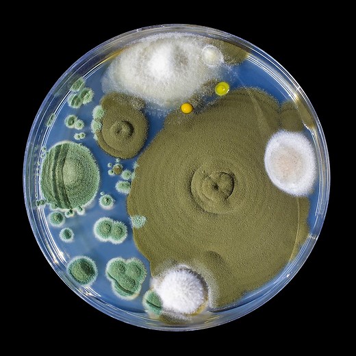 Mold, Histamine Intolerance, and Mast Cell Activation Syndrome: Everything You Need to Know