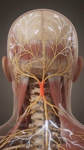 Occipital Neuralgia: Why Does the Back of Your Head Hurt? 🧠YouTube Description