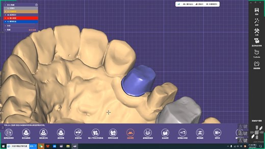 【EXO种植牙学习课程】EXO基础知识 隐藏功能_ev