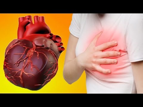 Sharp Stabbing Chest Pain That Comes And Goes: Causes And Treatment