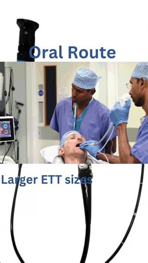 Fiberoptic intubation: Nose or Mouth?Nasal vs Oral #anesthesia #fiberoptic #airway#difficultairway