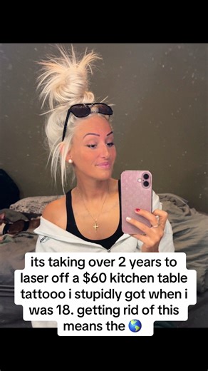 so close | Tattoo removal