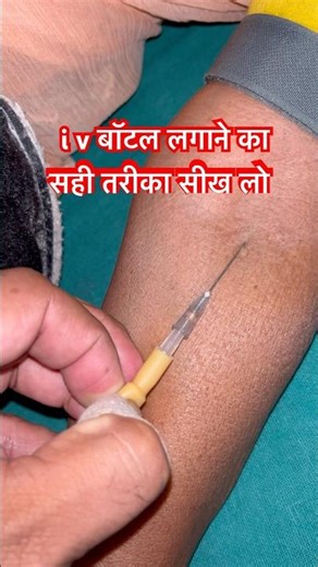 IV बोतल लगाने का सही तरीका | Step by Step IV Fluid Administration