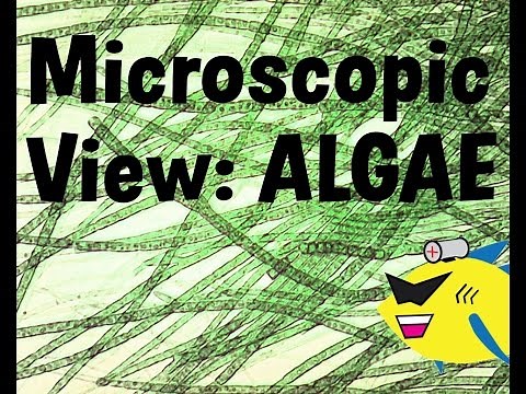 Microscopic View of Algae in the Aquarium