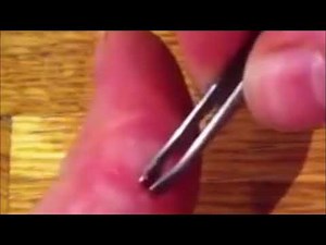 Splinter removal Video in Thumb