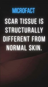 Scar tissue is structurally different from normal skin.