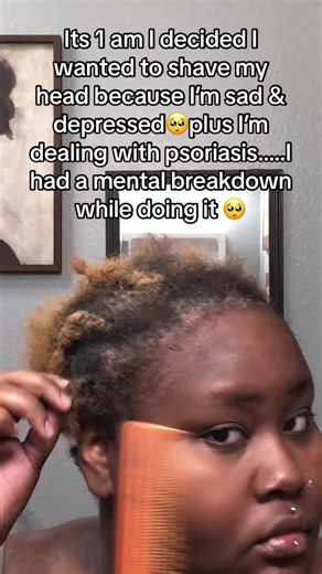 😭I was contemplating hard for bout an hr on whether or not I wanted to post this because ik its gone be jokes and/or maybe some negative comments😒but hey F it and F anybody who got something negative to say ❗️So when im going through depression I shave my head or either dye my hair.😭But this time I wanted to shave it all off again to see what my scalp looks like now while dealin w/ psoriasis and ima jus say this I had a mental breakdown while doing it🥺🥺#fypシ #psoriasisawareness #depresion #