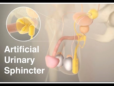 Artificial urinary sphincter (AUS)