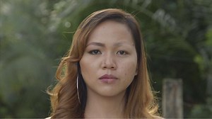 Find out how the viral 22-year-old girl is doing after losing her eyebrows from using a charcoal peel-off face mask