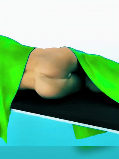 How Rubber Band Ligation Treats Hemorrhoids Without Surgery? #Hemorrhoids #pilestreatment #rubberbandligation #usa #medicalanimation