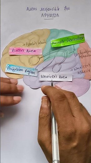 4 Types of Aphasia Explained | Broca, Wernicke, Conduction & Global