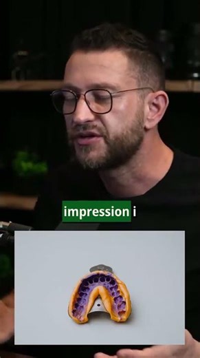 AI is a skill you have to learn - Peter Steinberger and Lex Fridman