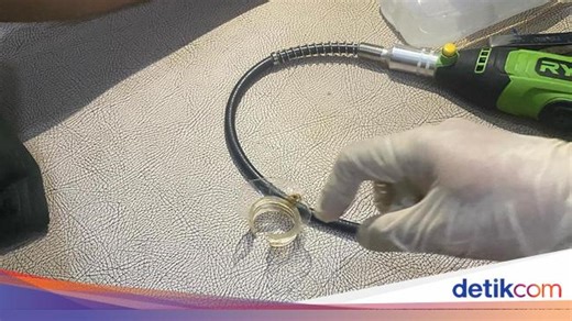 Remaja Ini Nangis Tak Bisa Pipis gegara Alat Kelamin Tersangkut di Botol