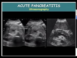 The Hepatobiliary System in Radiology: Anatomy and Pathological Insights | Radiology Lecture