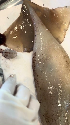 Squid eye dissection : STEM CLASS