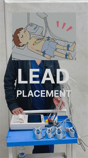 Sandhya Dhakad on Instagram: "ECG ( Part-2 ) 🏥👩‍⚕️ . . #medico #knowledge #medical #device #hospital #settings #explore #reels #trending #instagram #viral"