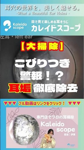 【大掃除】こびりつき警報！？耳垢徹底除去