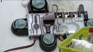 Gene therapy trial gives hope to people with Haemophilia B