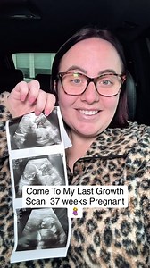 17K views · 108 reactions | Come with me to my 37 week Growth Scan & Consultant Appointment 勺 This week was my last growth scan  But we are down to are final days now . Hospital Bags : @ulluvdotcom This pregnancy im hopefully going to be encapsulating my placenta and using @placentatlc . A massive thank you to @anewmum for these amazing gifts going straight into my hospital bag. #PR GIFT #prenancy #family #plussizepregnancy #37weekspregnant | Shapes & Shadows Blog | Facebook