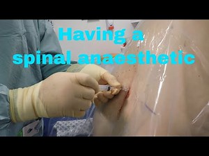 Having a spinal anaesthetic