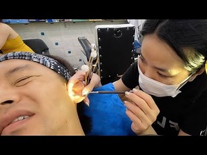 Ear cleaning requires professional care