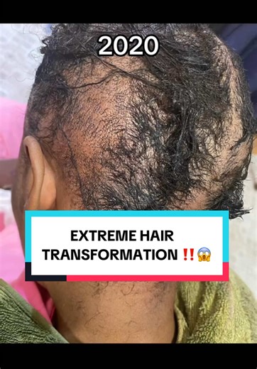 Magical Hair Growth Potion: Transform Your Hair!