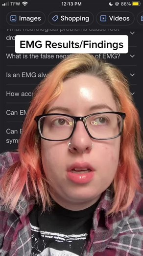 The emg/ncs doesn’t test for any central nervous system causes, only peripheral. So I could still have an issue with my cns or spine or muscles. Still gonna keep doing my PT & eating protein but I’ll keep you all updated on this mystery. #greenscreen #medicalmystery #undiagnosed #footdrop #dropfoot #cns #centralnervoussystem #emg #ncs #nerveconductionstudy #electromyography #neuromusculardisorder #kneebuckling #spoonie #chronicpain #chronicillness #disability #disabled